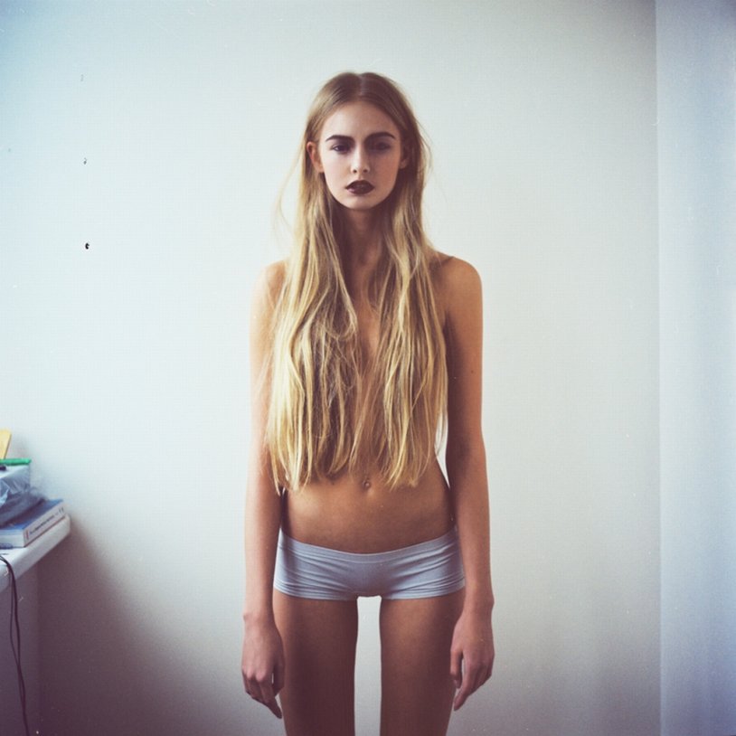 Sarah Spencer Anorexia
