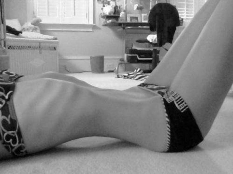 Anorexic with extended legs