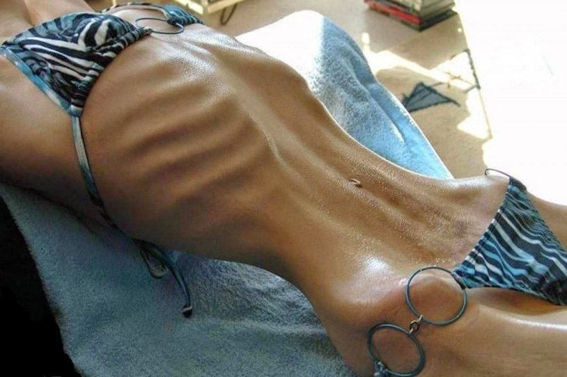 Flat belly of anorexics