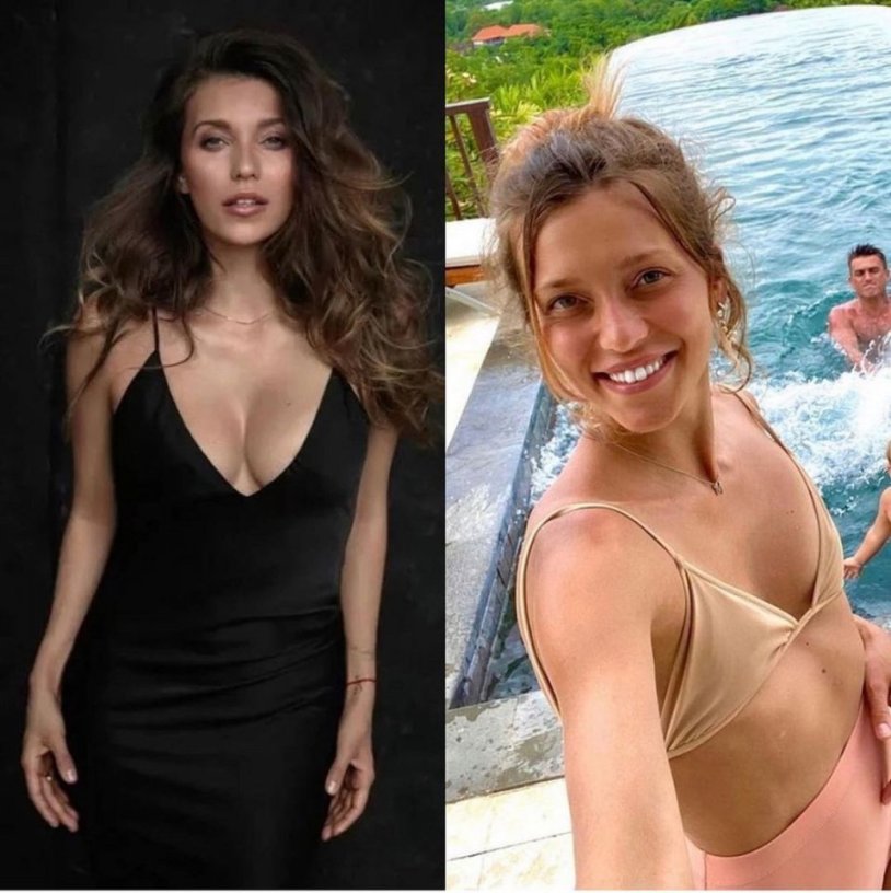 Regina Todorenko breasts before and after