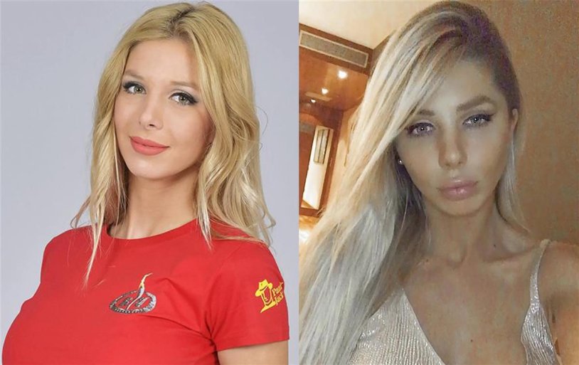 Romina malaspina before and after plastic