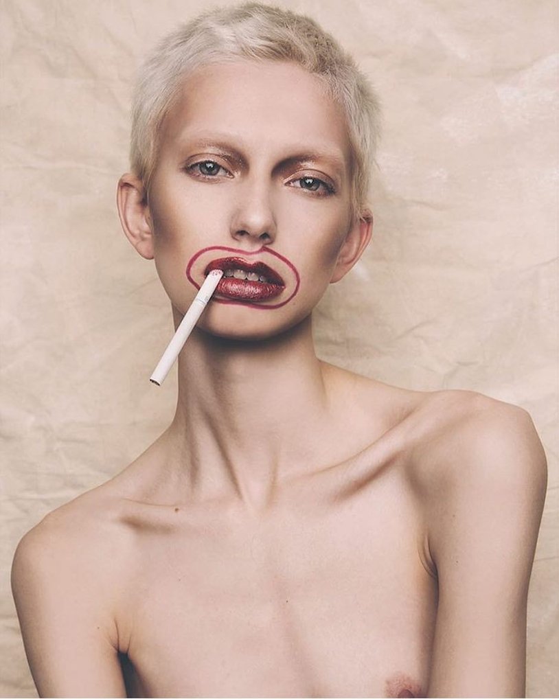 Anorexic blonde