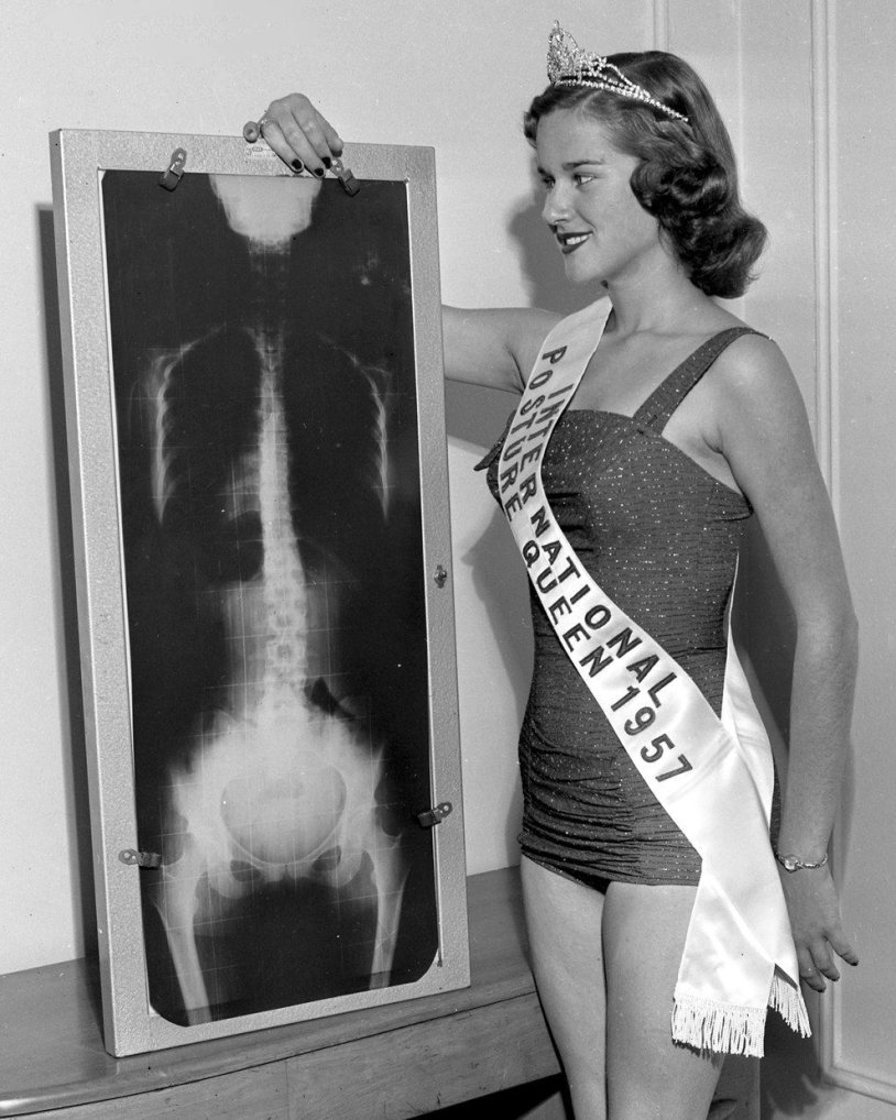 Miss Aidaho 1935