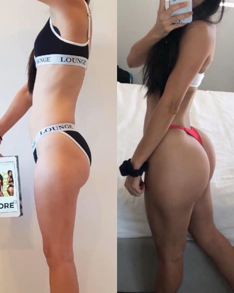 Transformation of the buttocks