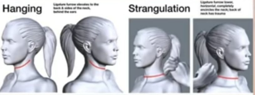 Epstein has a broken head