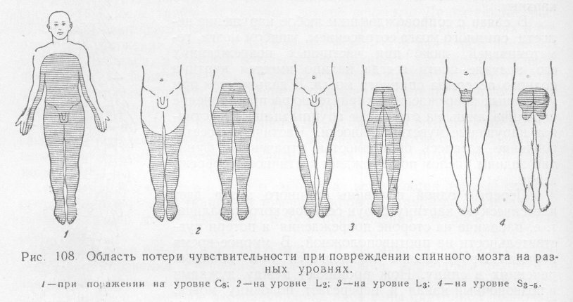 Spinal cord damage schemes at various levels