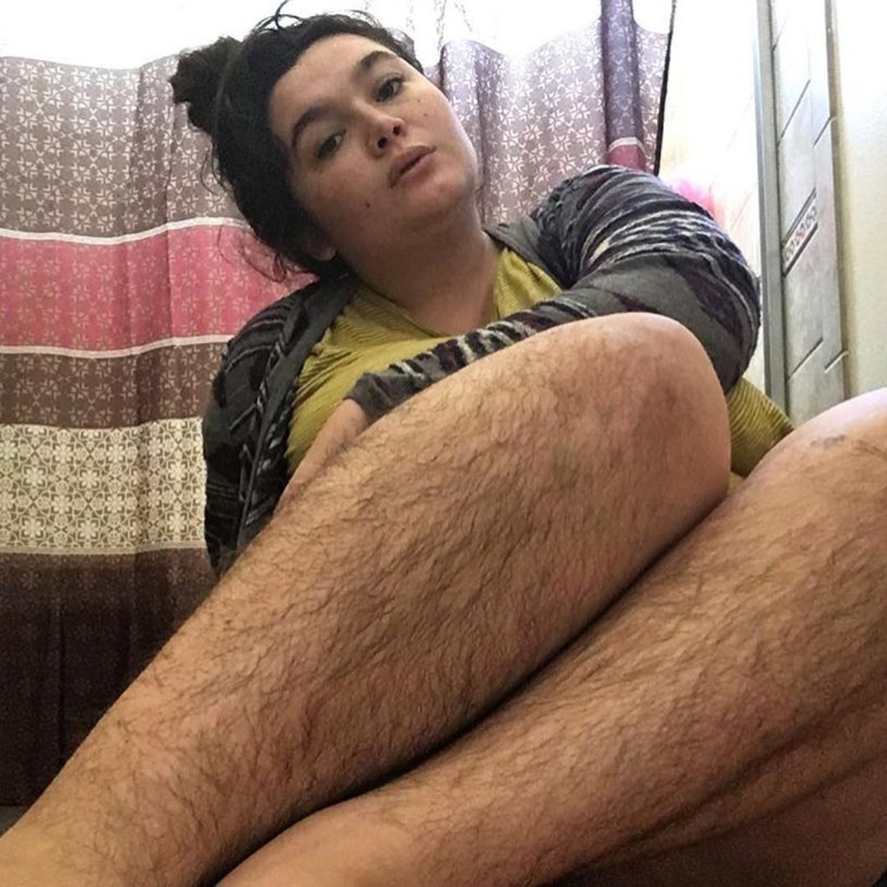 Hairy women's lower legs