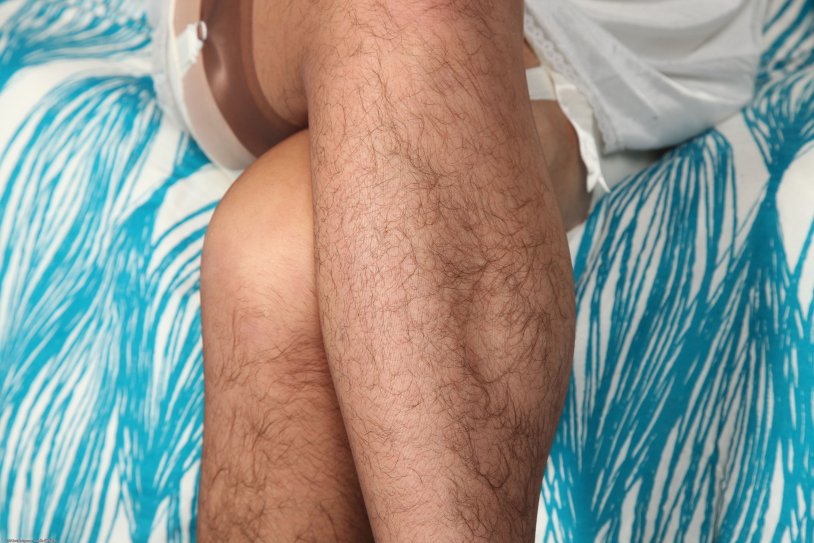 Very hairy women's legs