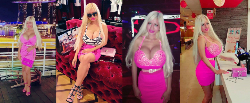 The girl turned into a silicone barbie