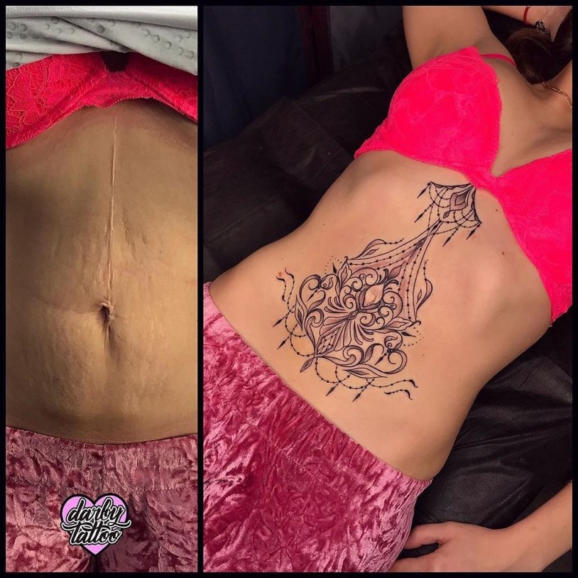 Tattoo on the stomach overlap of stretch marks
