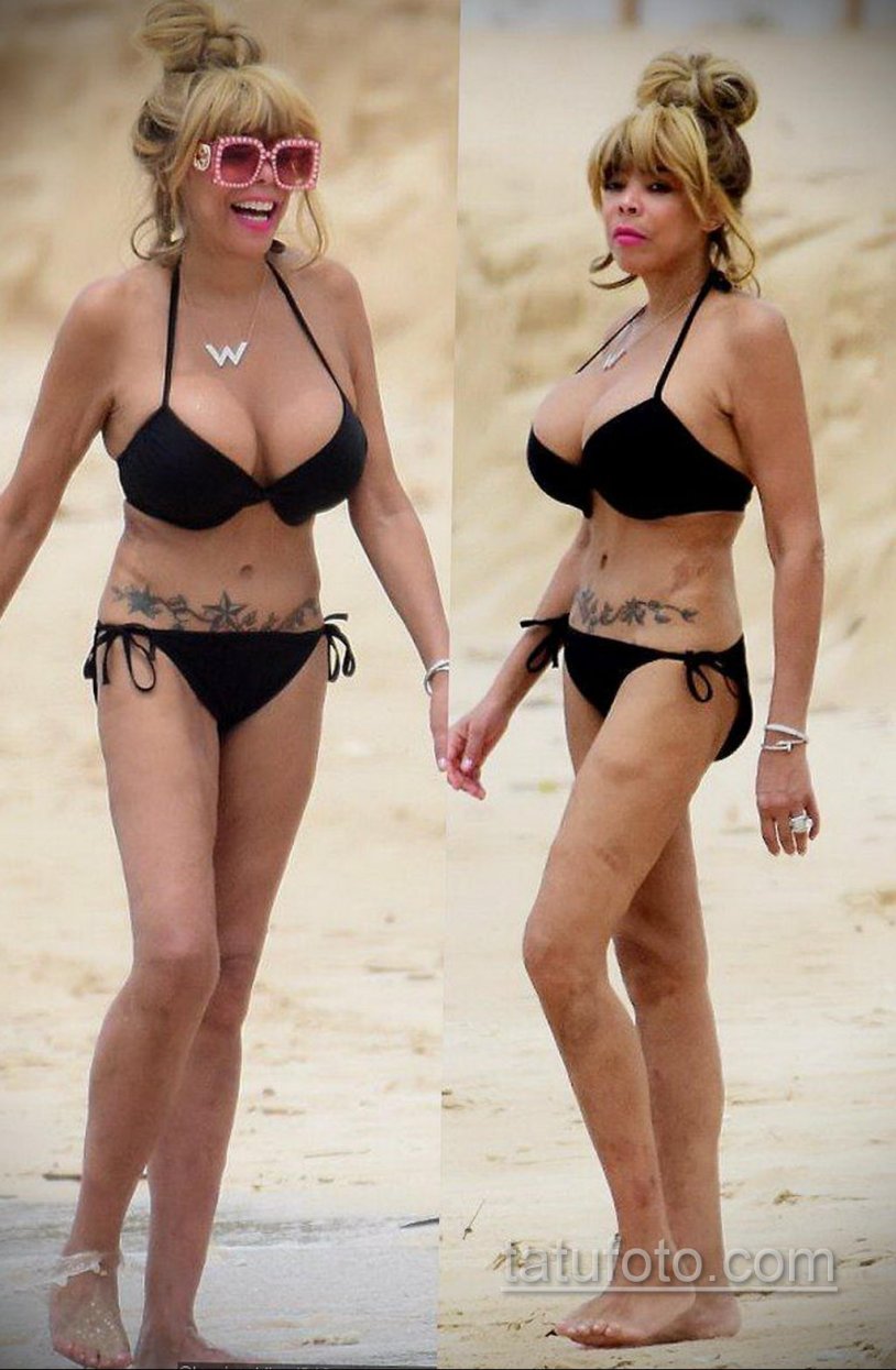 Madonna before and after the plastic of the buttocks