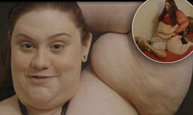 Obesity of 4 degrees in women