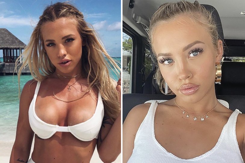 Tammy Hombrow to plastic