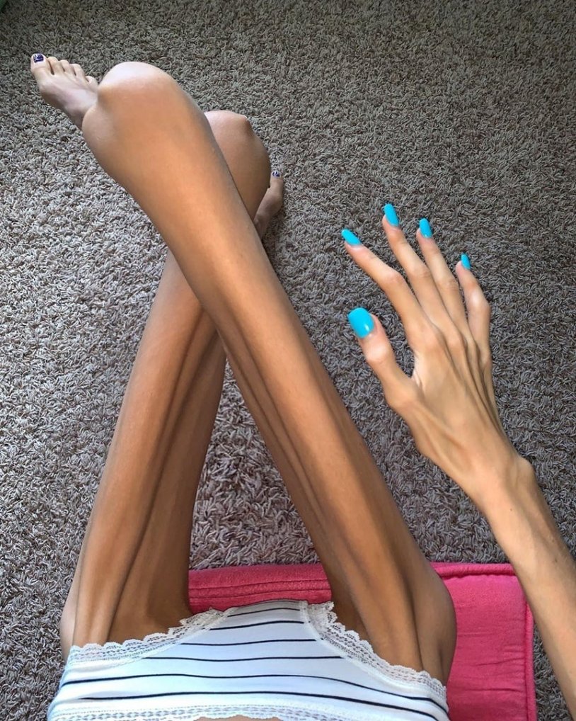 Flexible and naked anorexia