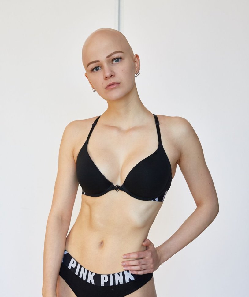 Bald girls in a swimsuit