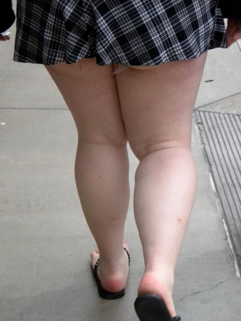 Fat Legs in Mini