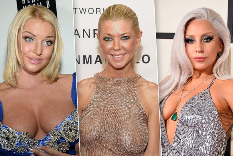 Stars with a sagging bust