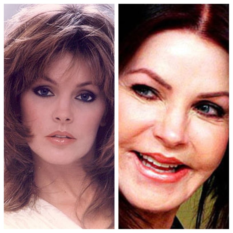 Priscilla Presley after plastic