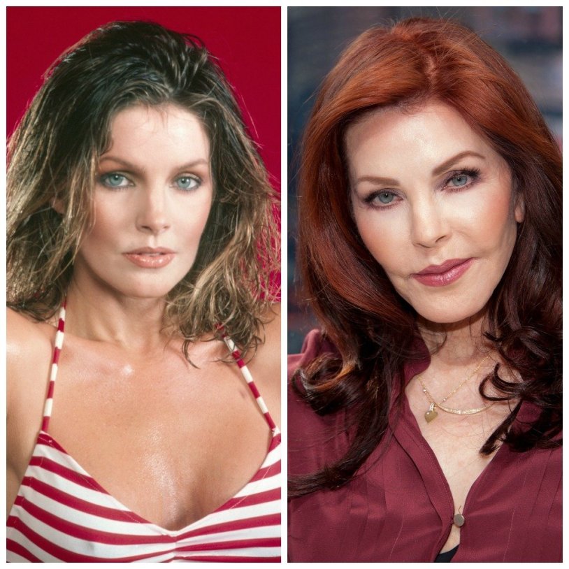 Priscilla Presley Plastic surgery