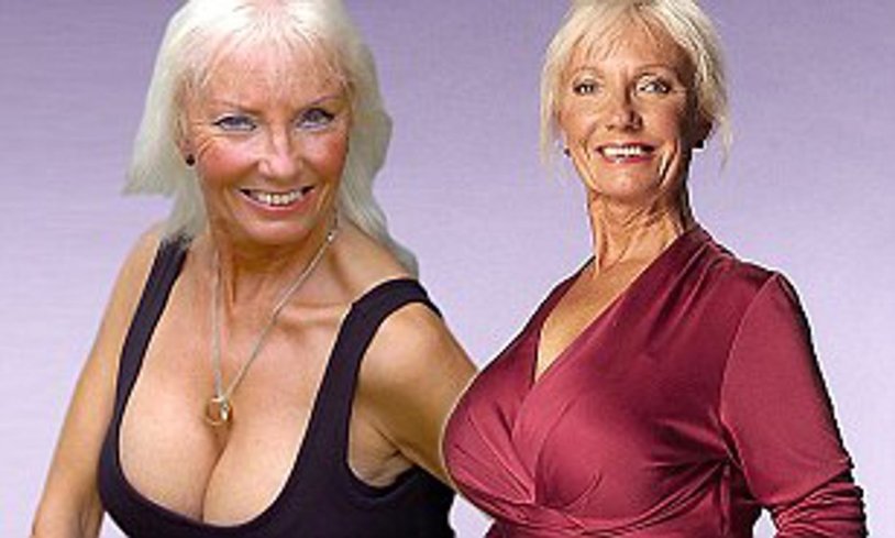 Female breasts in old age