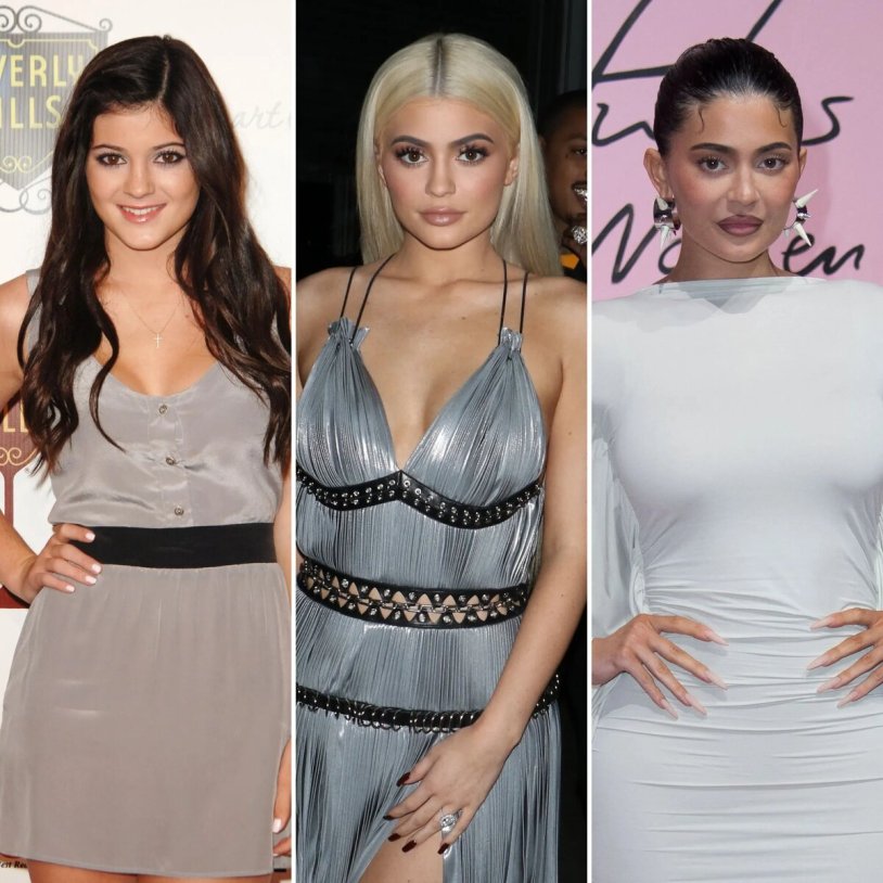 Kylie jenner plastic surgery