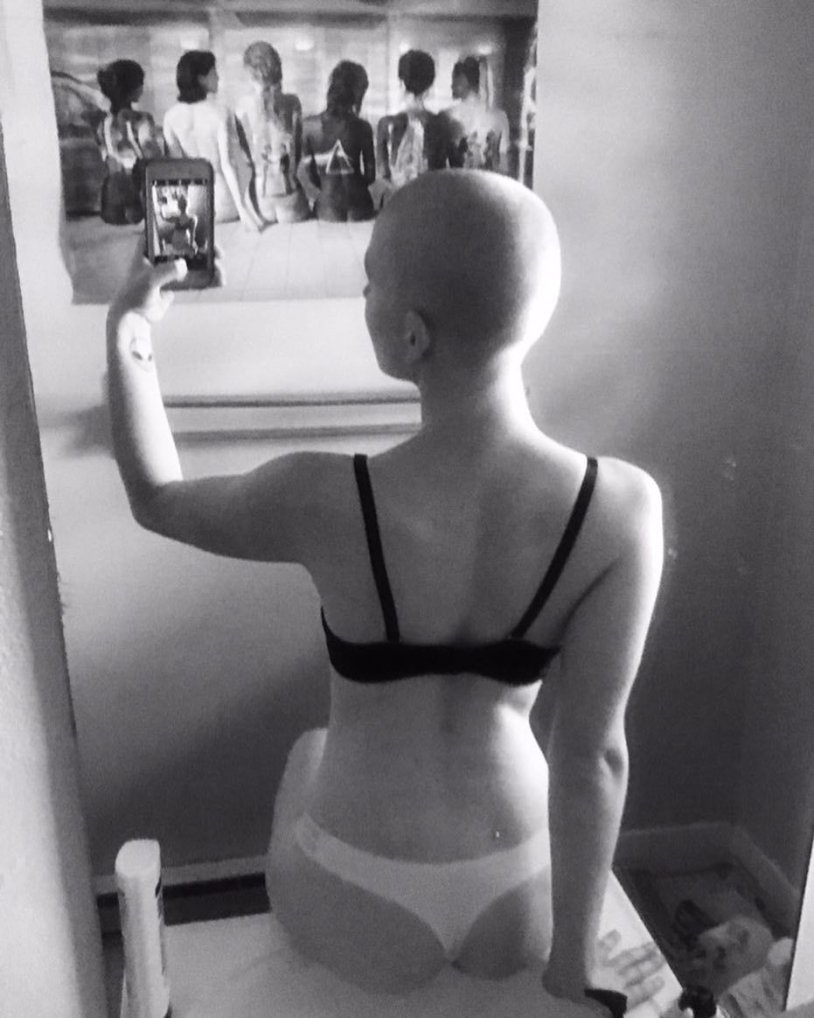 Bald girl from the back