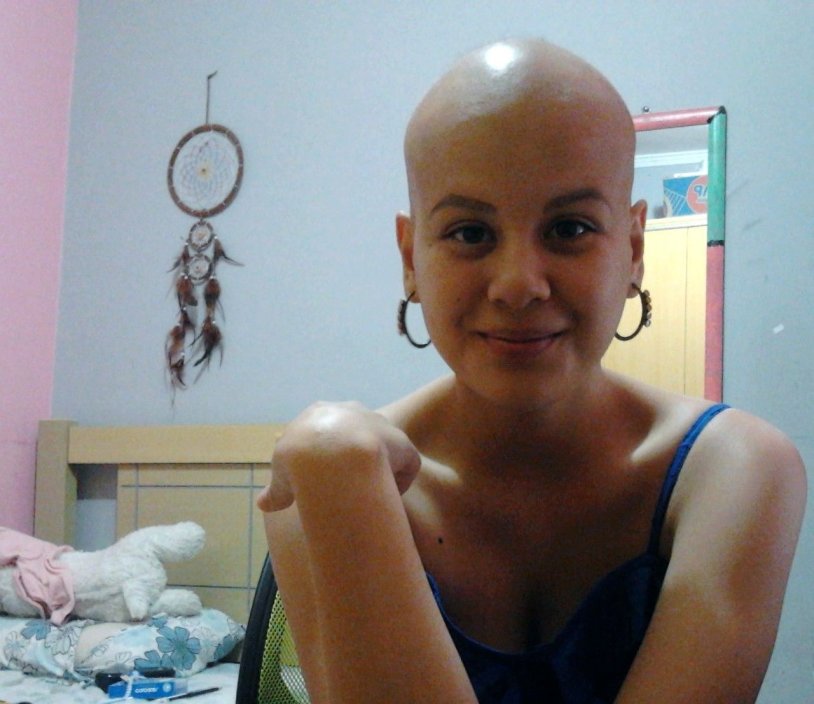 Two bald women