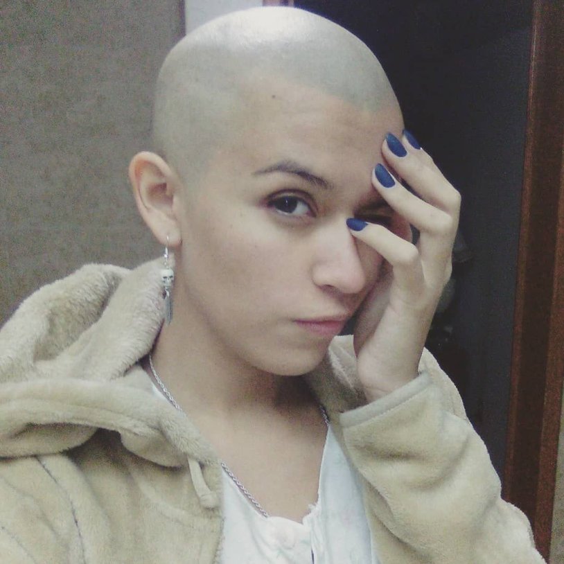 Nika Abramov is bald