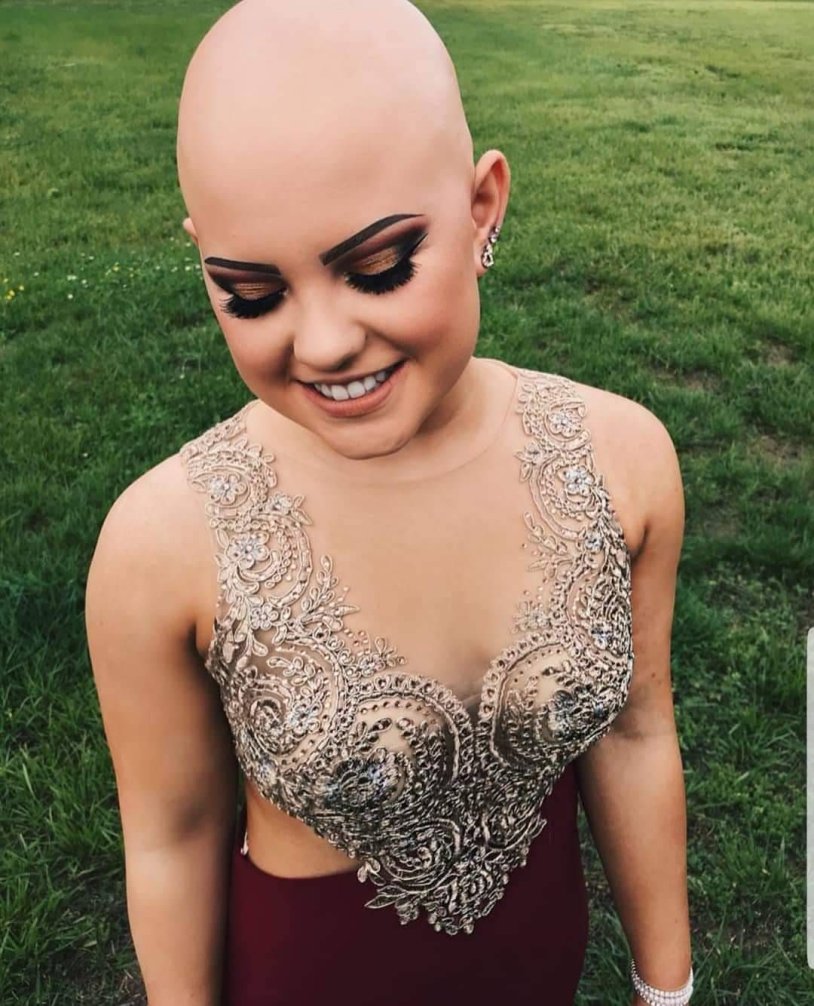 Bald girls are terrible