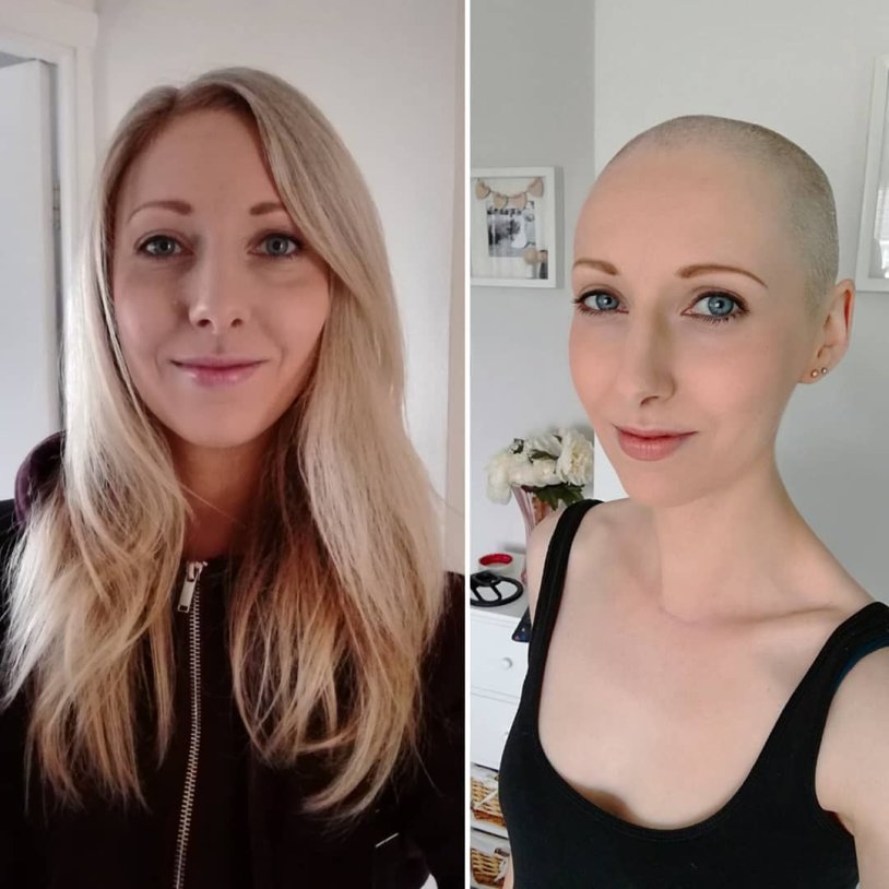 Headshave Before After