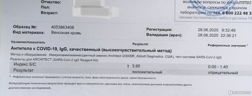 IGG antibodies to Coronavirus (Sars-COV-2)