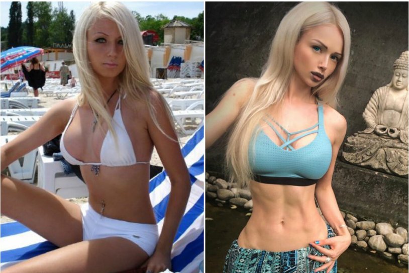 Valeria Amatue21 Lukyanova before surgery