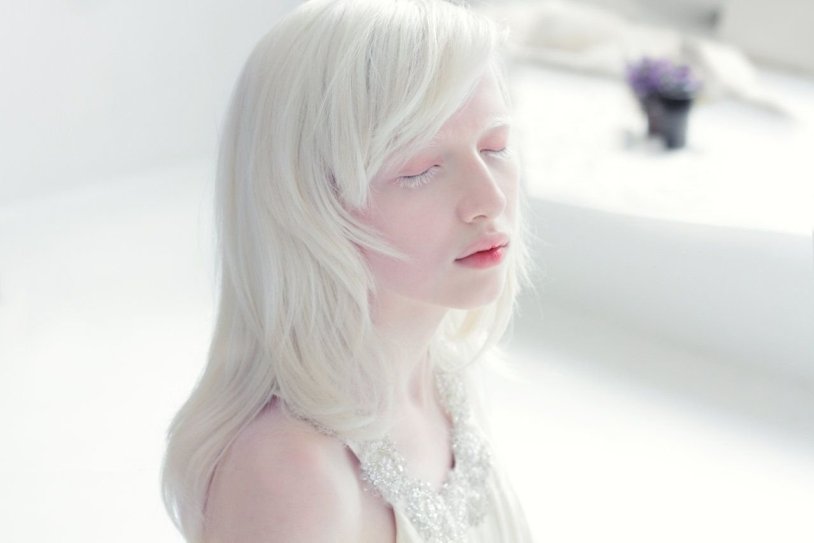 Amelia Newsham Albino