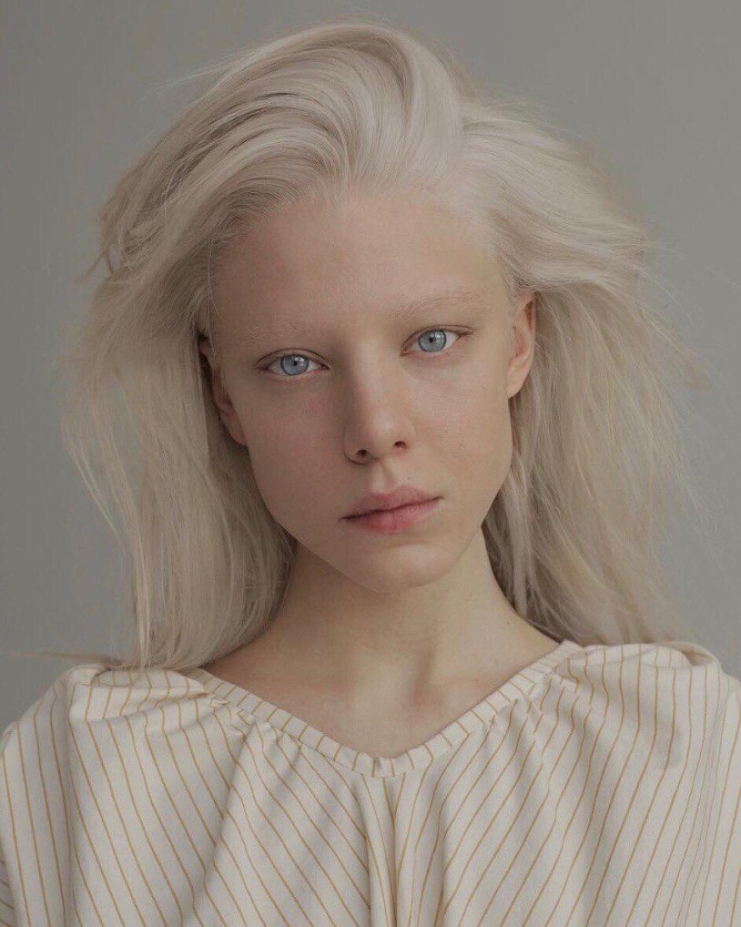 Alena Mikhailova Albino