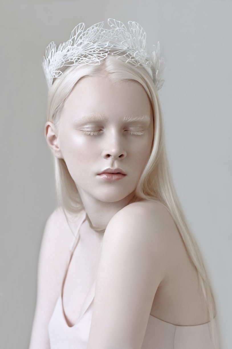 Rosie Crawford Albino