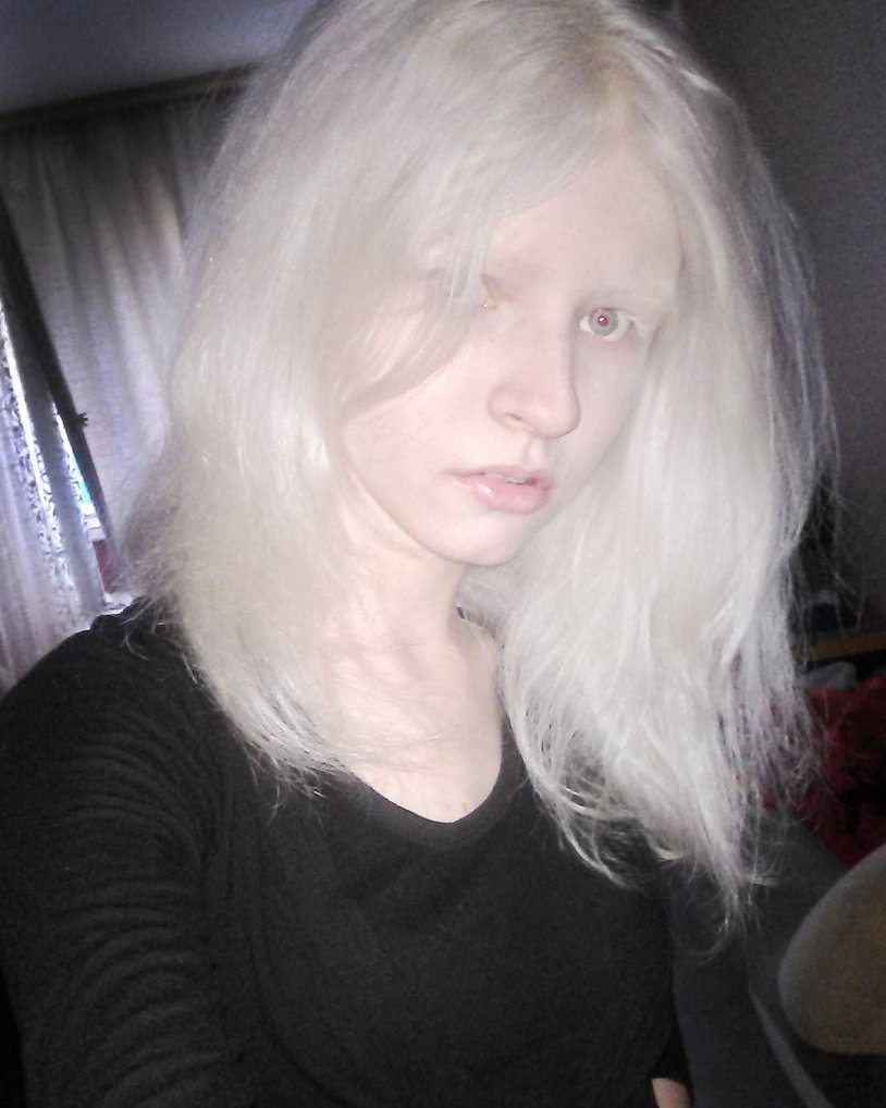 Tanya Rumyantseva Albino