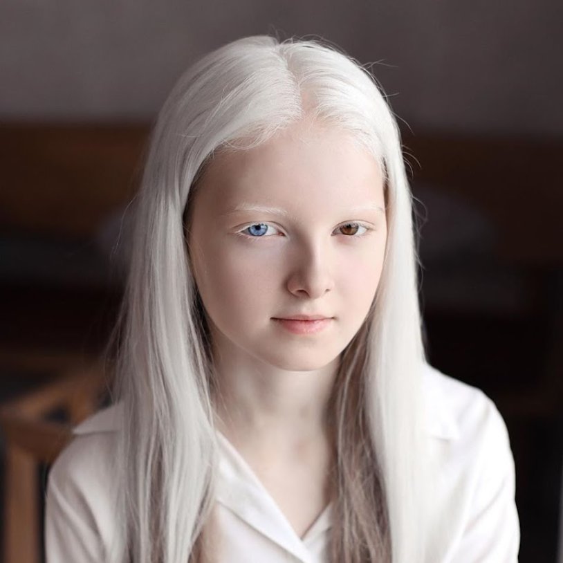 Amina Ependieva Albino