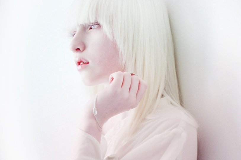 Albino with pink hair