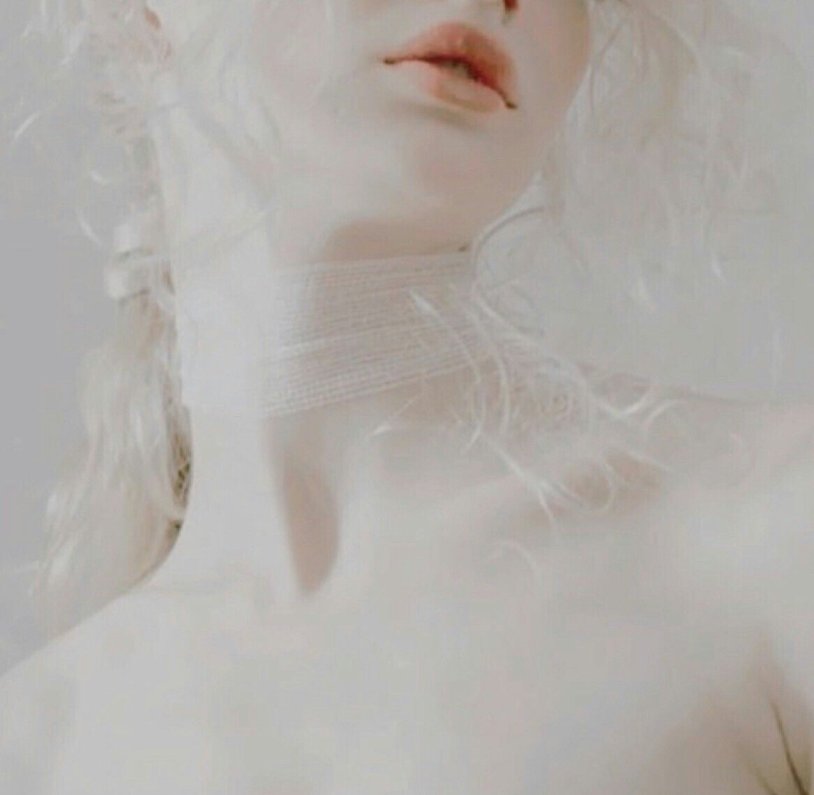 Rosie Crawford Albino