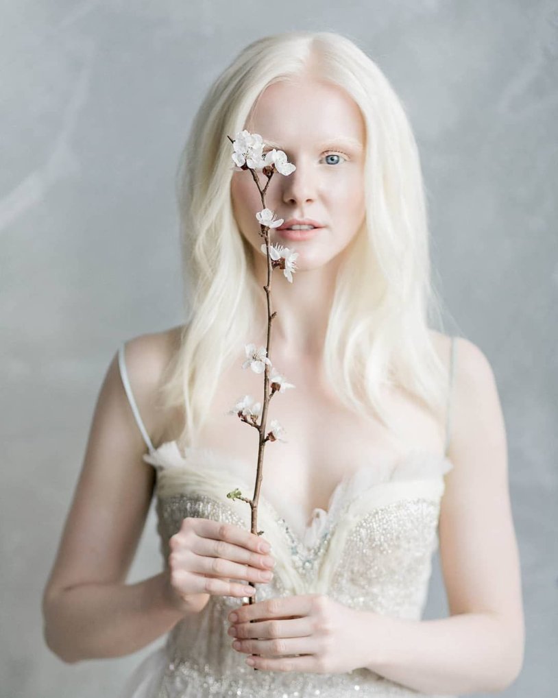 Katerina Tymoshenko Albino
