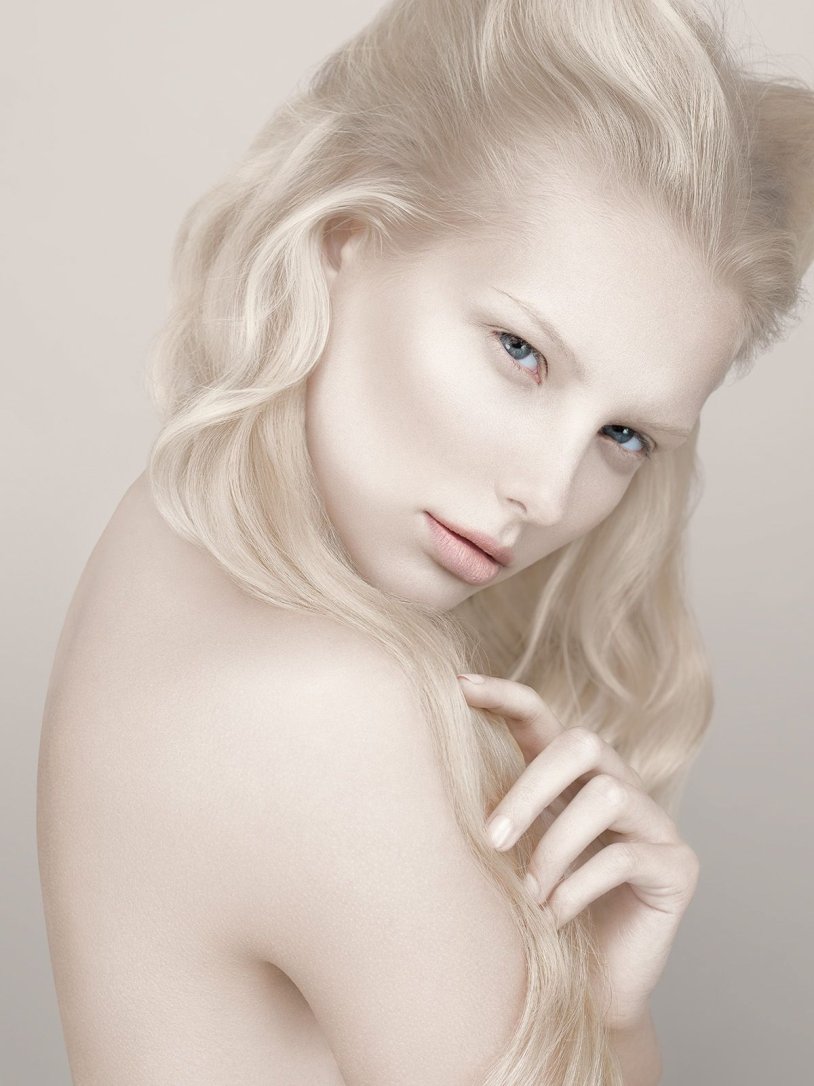 Rosie Crawford Albino