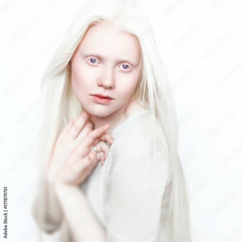 Diana Nikitina Model Albino