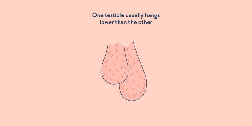What Does a Testicular Cancer Lump Look Like