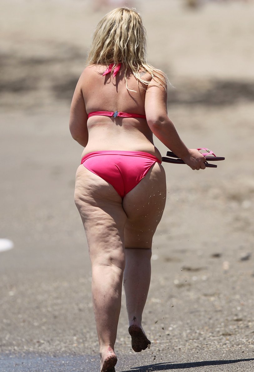 Josie Gibson cellulite