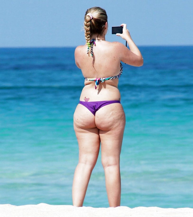 Cellulite hips on the beach