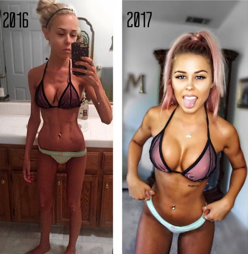 Thin girl with silicone breasts