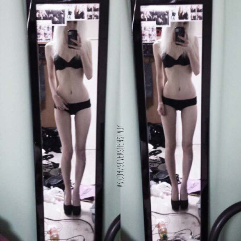 Anorexia in underwear