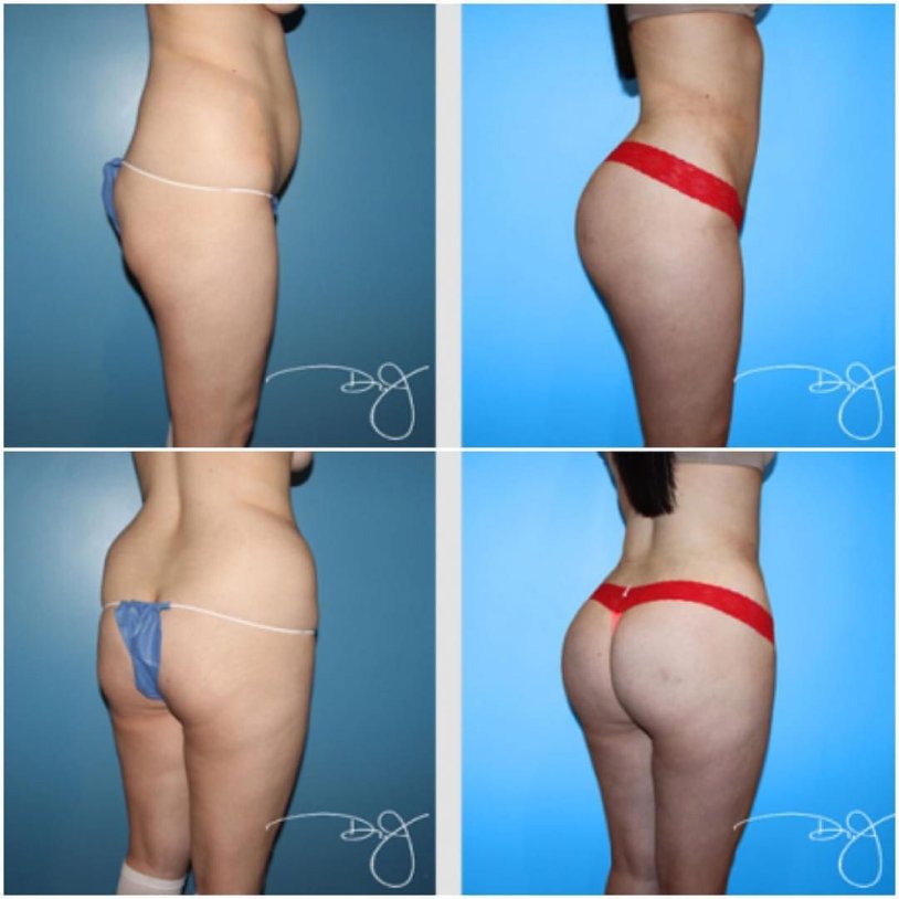 Increase in the priests