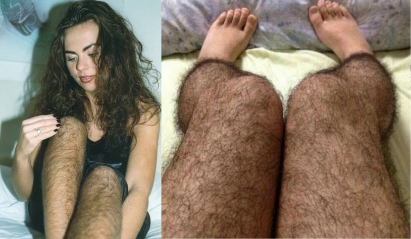 Beautiful girls with hairy legs