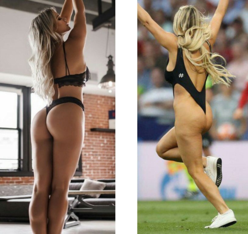 Kinsey Volanskoye cellulite